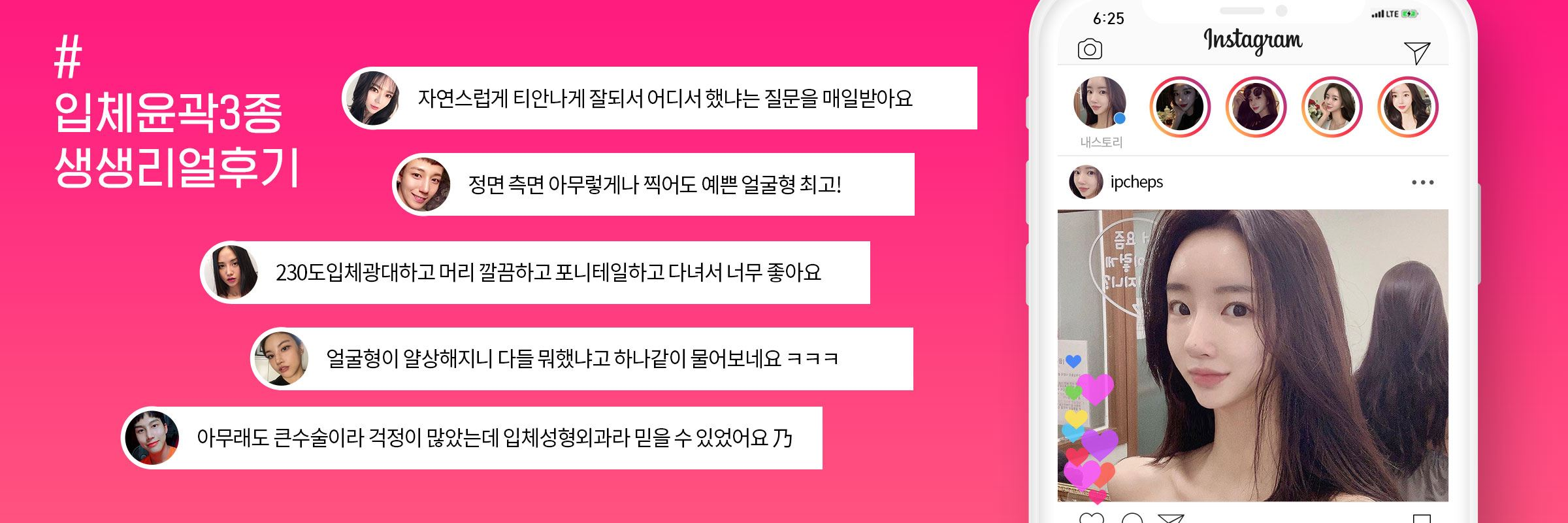 리뷰 이벤트를 통한 병원마케팅 예시